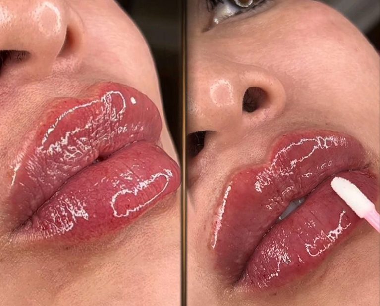 lips 2